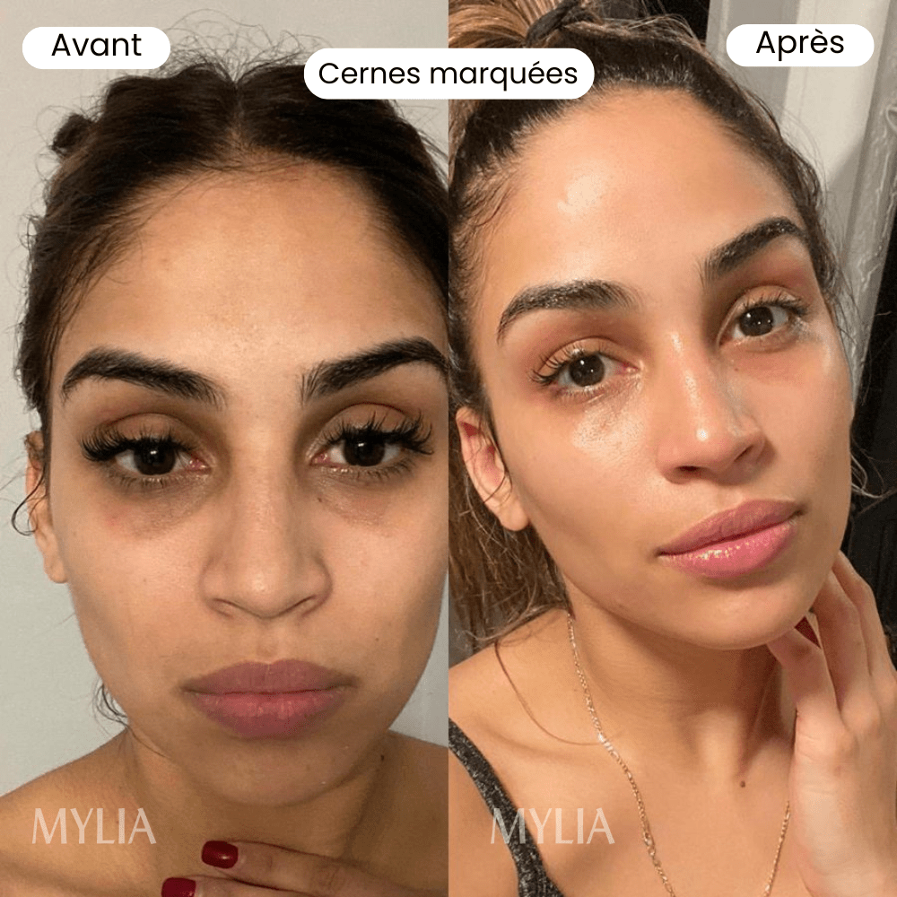 Bálsamo hidratante - Mylia Care