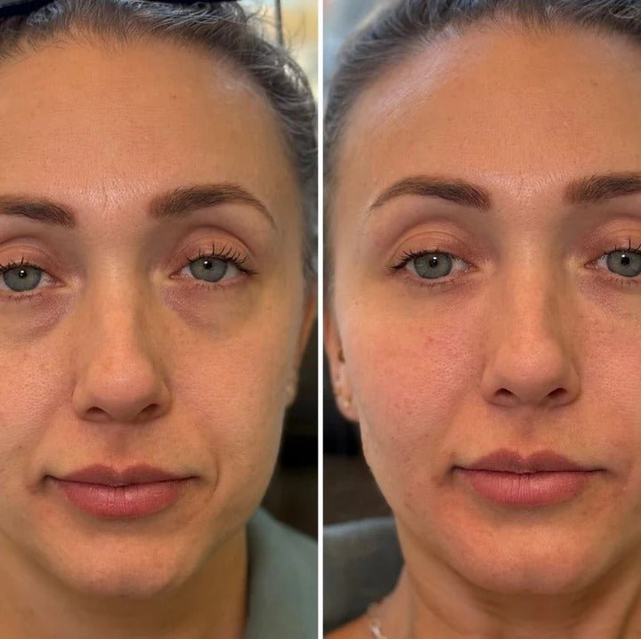 Efecto buena cara: Despierta tu mirada y borra el cansancio en 10 minutos. - Mylia Care