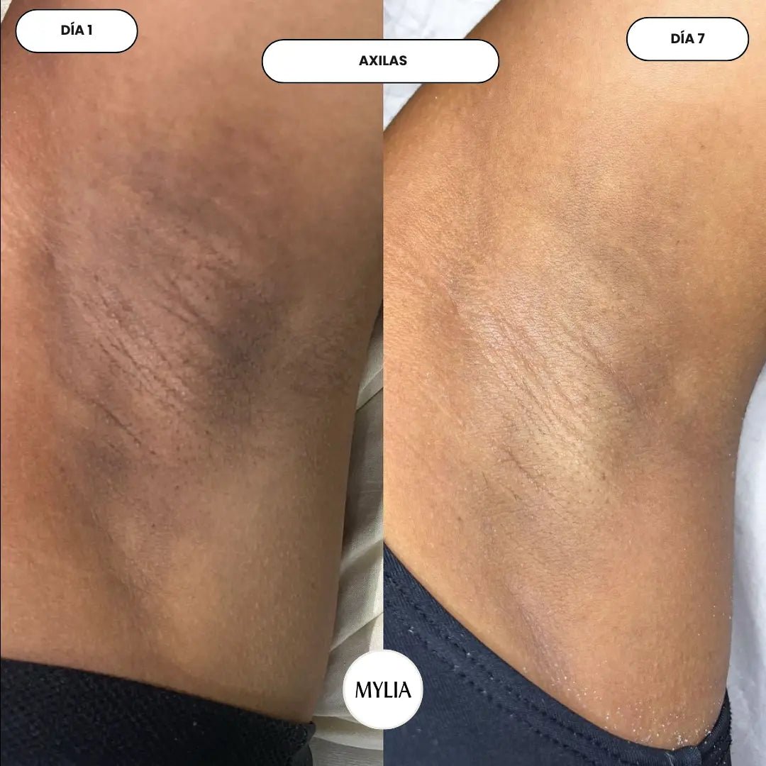 It evens out skin tone and visibly reduces persistent dark spot. - Mylia Care