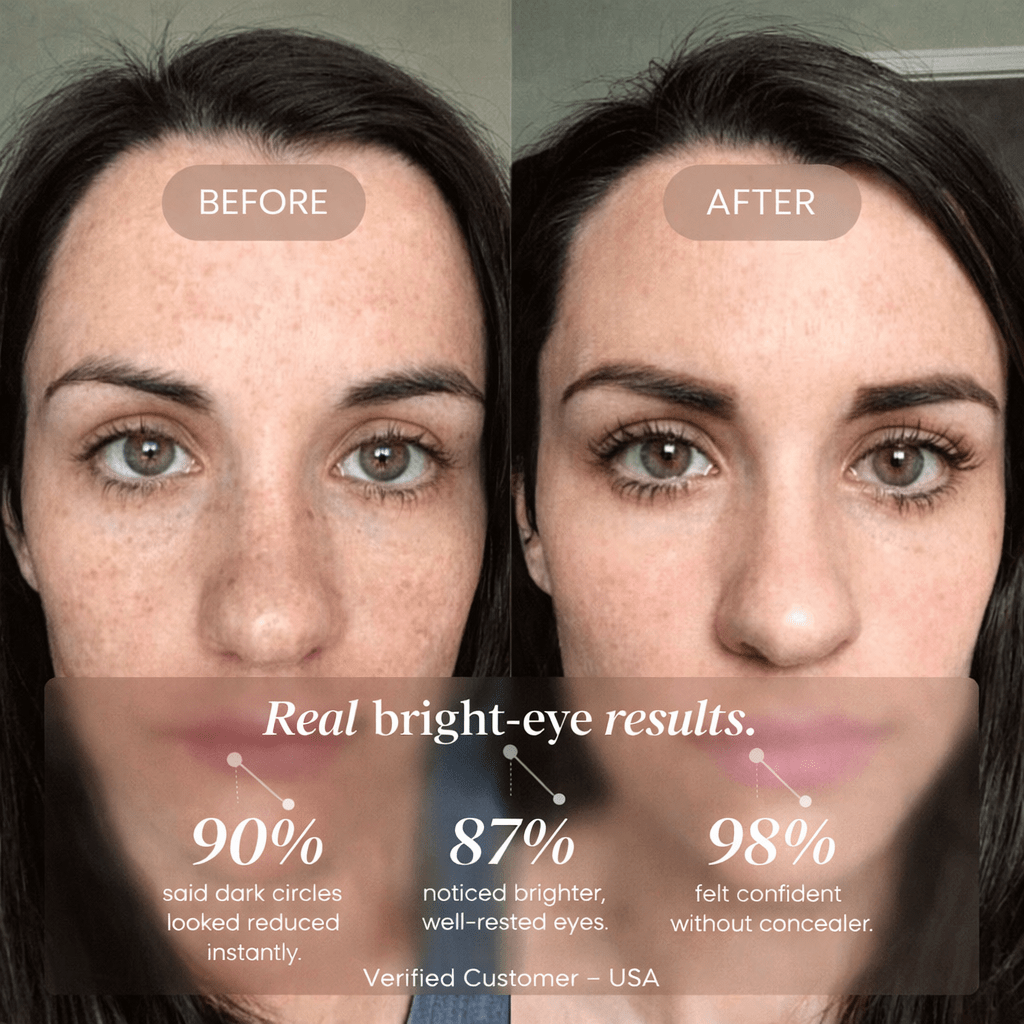 Le Correcteur Nouvelle Génération Pour Un Regard Lumineux - Mylia Care